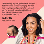 Viviscal Advanced Hair Growth Supplement