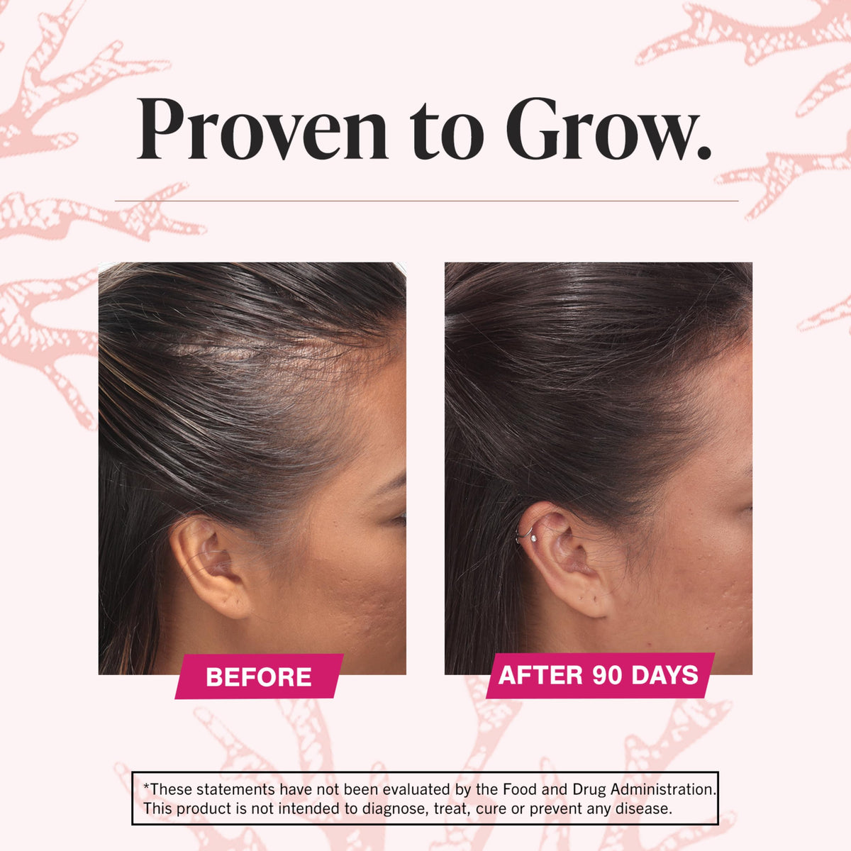 Viviscal Advanced Hair Growth Supplement